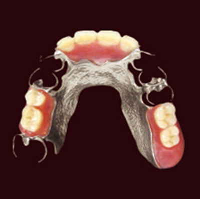 入れ歯
（金属床）